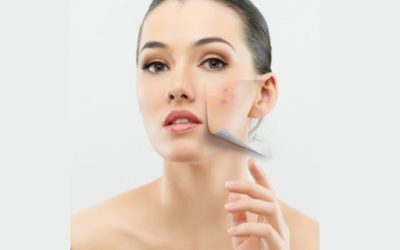 Peeling: tipos y beneficios